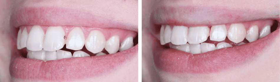Composites Before & After
